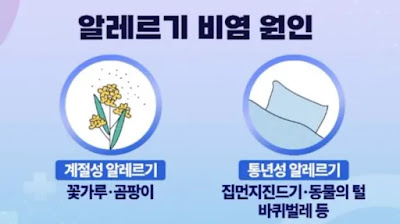 알레르기성 비염