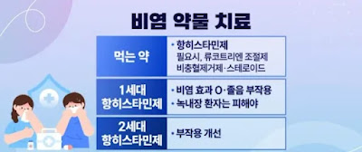 비염 약물 치료